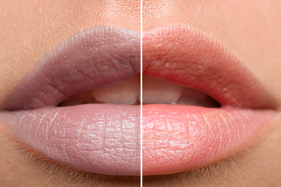 Have your lips turned black due to long-term neglect and cigarette addiction?