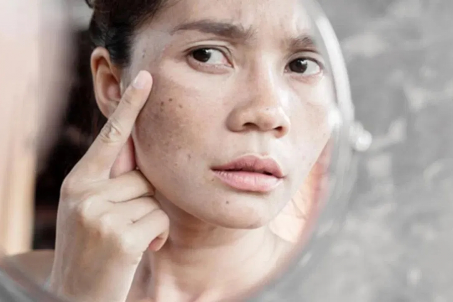 Is your skin losing its glow due to hypothyroidism? Here's an easy way to restore your appearance