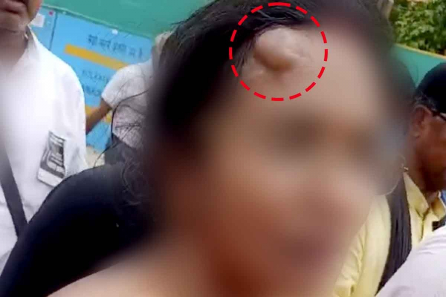 The victim's mother's forehead is swollen, her determination to fight is surprising