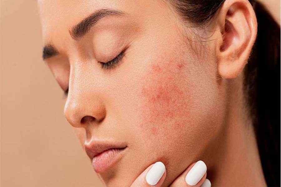 Skin-Care-स्किन-केयर-रुटीन-में-शामिल-करें-हल्दी-आपको-मिलेगा-नेचुरल-निखार
