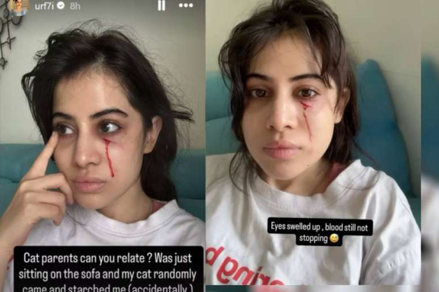 Urfi Javed was suddenly attacked, eyes swollen and blood started coming out of his face, video went viral