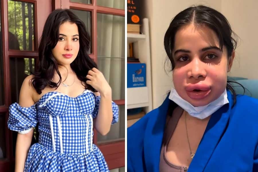 What a situation this is in the guise of beauty care! Be informed and stay cautious.